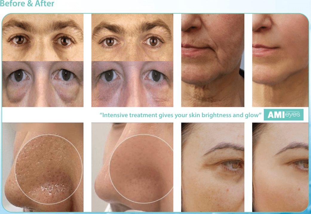 Estaderma Ami Eyes(PN)